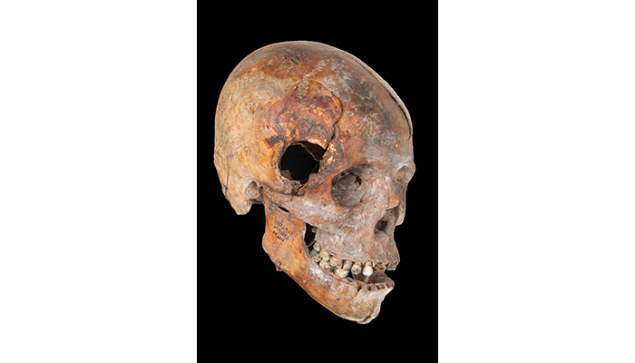 skull of a black Union soldier of the 54th Massachusetts