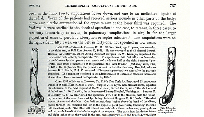 Page Scan from The Medical and Surgical History of the War of the Rebellion