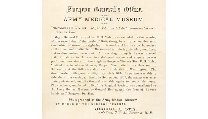Surgeon Generalâs Office record for Maj. Gen. Sickles
