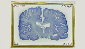 Neuroanatomical Collections