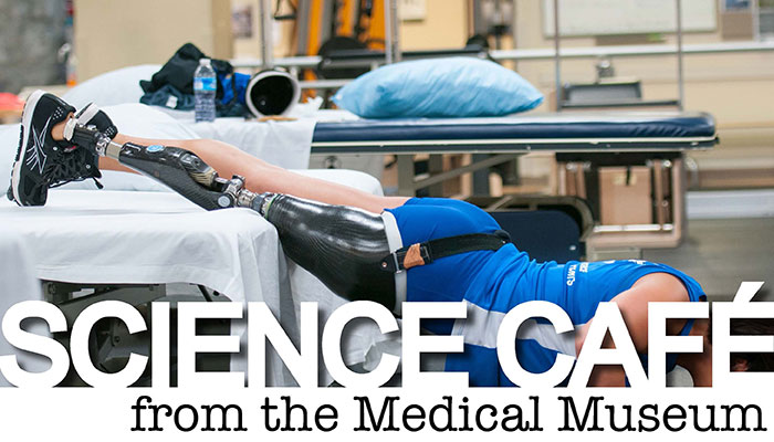 Medical Museum Science Café: DoD Multi-Disciplinary Rehabilitation for Limb Trauma