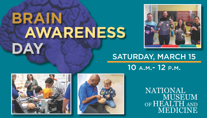 Brain Awareness Day