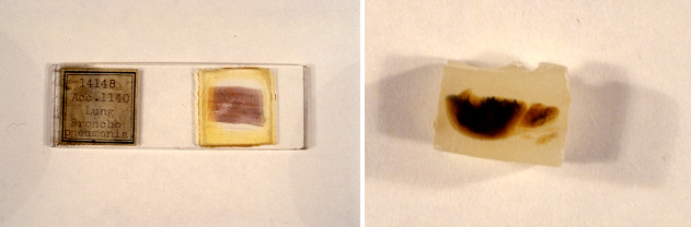 Glass slide with a mounted lung specimen section on left, paraffin block on right.