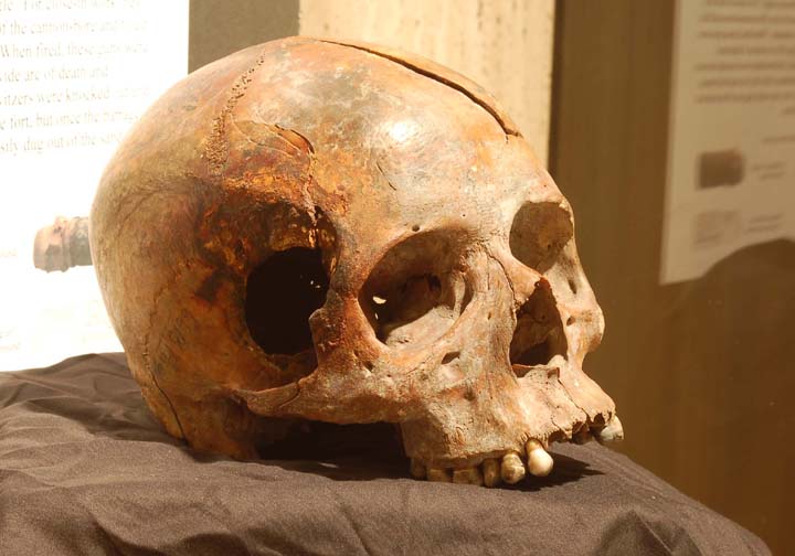 Skull on display