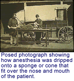 Posed
      photograph showing how
      anesthesia was dripped onto a sponge or cone that fit over the nose and
      mouth of
      the patient.
