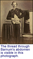 The thread through Barnum's abdomen is visible in this photograph