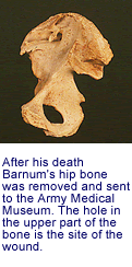 After his death Barnum's hip bone was
    removed and sent to the Army Medical Museum. The hole in the upper part
    of the
    bone is the site of the wound.