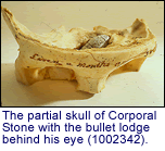 The partial skull of Corporal Stone
  with the bullet lodge behind his eye (1002342).