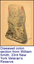 Diseased colon section from William
      Smith, 33rd New York Veteran's Reserve.