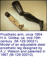 Prosthetic arm, circa 1864.  H.A.
      Gildea, ca. mid-19th century  (M-129 00021).  Model of an adjustable
      steel
      prosthetic leg designed by A.J. Watson and patented in 1867 (M-129
      00010).