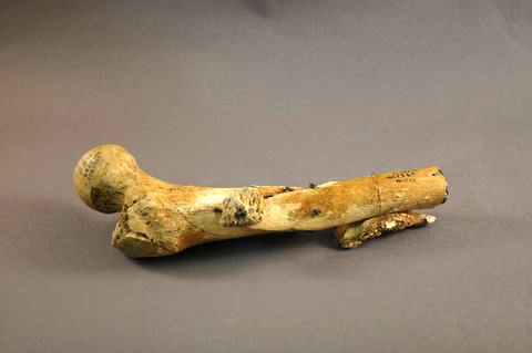 The upper thigh bone of Private Oscar Wilber.
National Museum of Health and Medicine 1000513