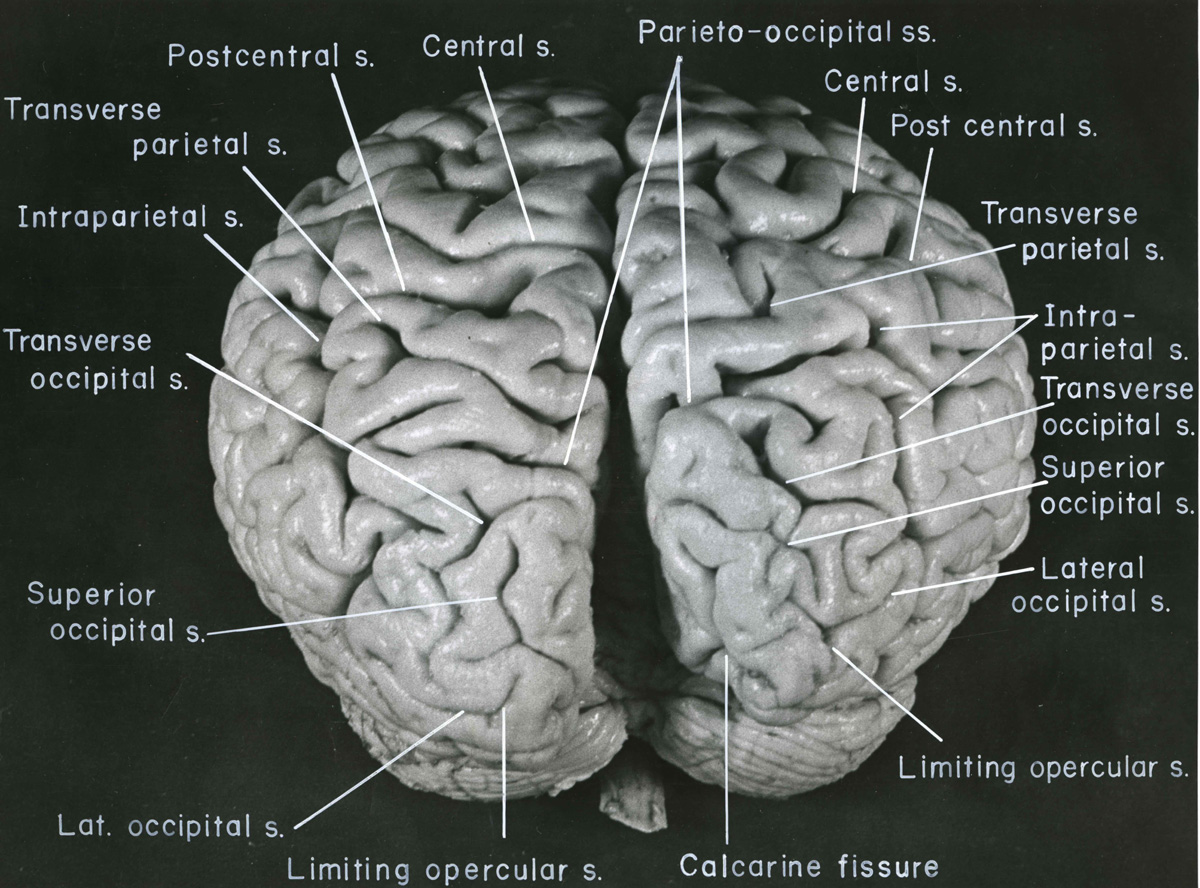 einstein brain vs normal brain